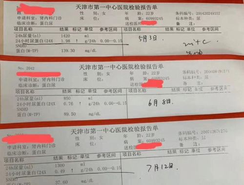 高热量食物有哪些 吃多了易发胖又不利于健康